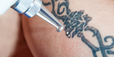 a close up of a tattoo on their face