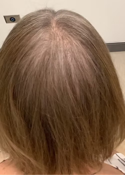a close up of a person