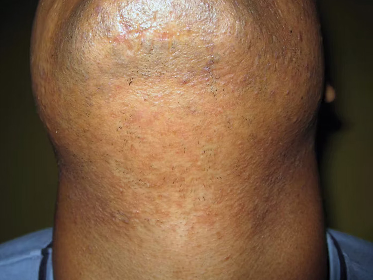 a close up of a man