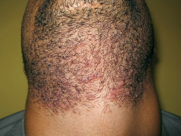 a close up of a man