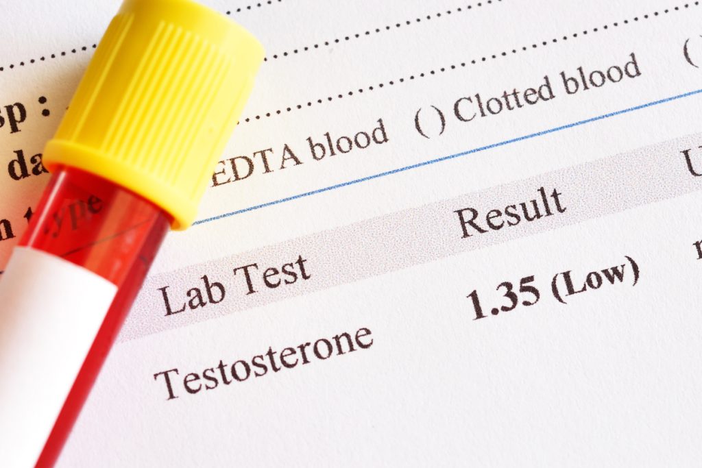 Close-up of a blood panel results sheet during a men's hormone evaluation at a clinic in Tuscaloosa, Alabama.